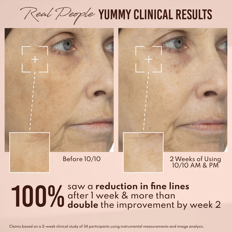 Yummy Skin 10/10 Barrier Boost Hyaluronic Acid + Ectoin Plumping Serum