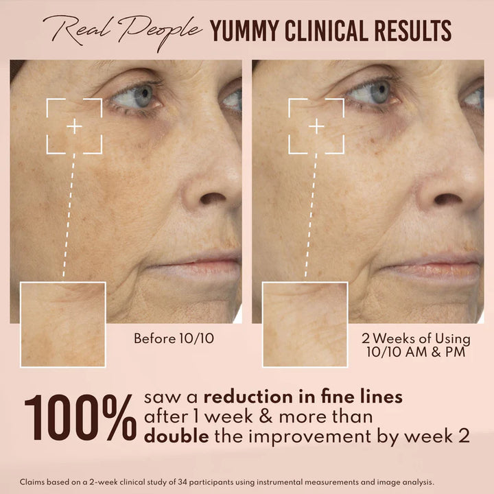 Yummy Skin 10/10 Barrier Boost Hyaluronic Acid + Ectoin Plumping Serum